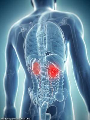 Kidney treatment