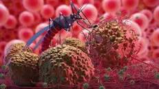 Malaria