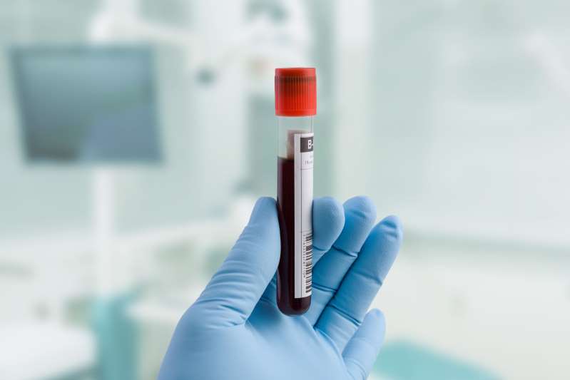 cancer blood test