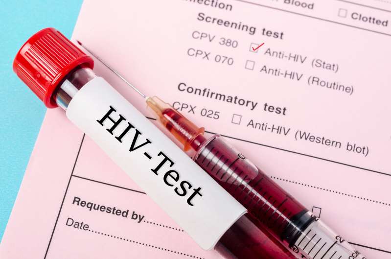 stemcells Hiv