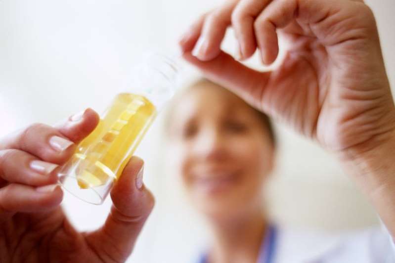 urine test